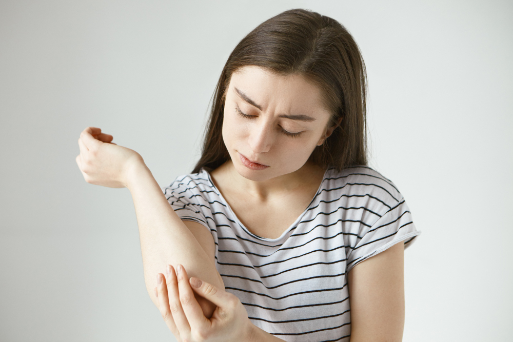 Eczema